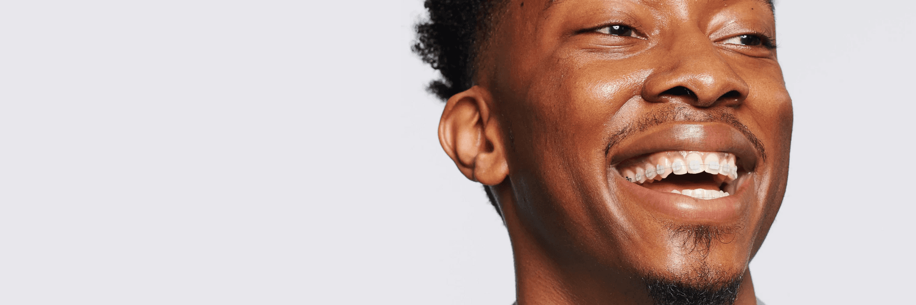 Lightforce Clear Braces | Dentist